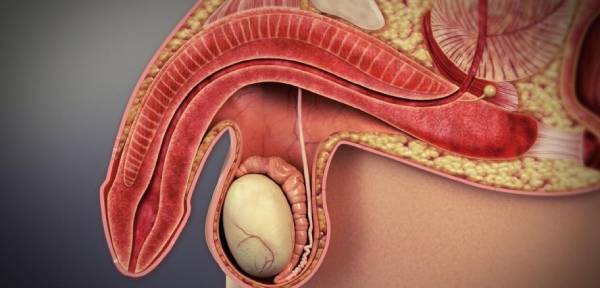 کجی آلت تناسلی به سمت پایین